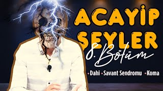 ACAYİP ŞEYLER 8 BÖLÜM Dahi Savant Sendromu Koma [upl. by Lexa]