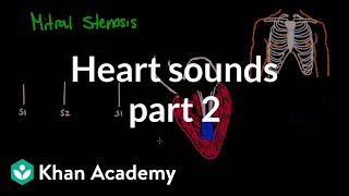 Systolic murmurs diastolic murmurs and extra heart sounds  Part 2  NCLEXRN  Khan Academy [upl. by Haceber375]