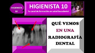 ¿QUÉ VEMOS EN UNA RADIOGRAFÍA DENTAL CÓMO ANALIZAR Y DESCIFRAR UNA RADIOGRAFÍA DENTAL TEMARIO 34 [upl. by Anoli263]