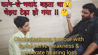 कान का बहना  चेहरा टेढ़ा होना  csom mastoiditis nerve palsy nerve grafting in pediatric patient [upl. by Margalo]