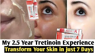 Tretinoin Creamafter using 1 Year full details002500501Pm Skincare with retinAin 2022 [upl. by Nahsaj]