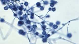 Fungal Pathogens Part 2 of 2 [upl. by Asi]