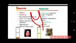 Internal Medicine  Nephrology Glomerulonephritis GN [upl. by Esinyt]