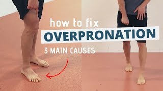 Pronated Feet and How to Fix 3 Different Causes of OVERPRONATION [upl. by Yona]