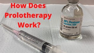 How Does Prolotherapy Work Prolotherapy Explained [upl. by Blythe]