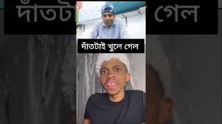 দাঁতটাই খুলে গেল  Abeg Caca ac youtube funny comedy funnyshorts [upl. by Enid]