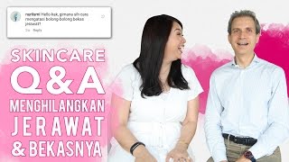 Produk untuk Jerawat dan Bekas Jerawat  Instagram QampA  Skincare 101 [upl. by Aikcir]