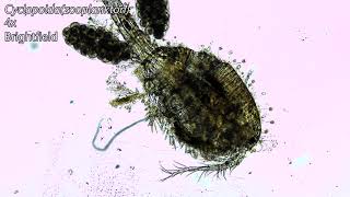 Cyclops plankton covered in other microorganisms microscope view [upl. by Coe]