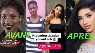 😂 AVANT APRÈS DE AMY LÉA abonnetoi fypシ゚viral viralvideoglowup transformation team221 senegal [upl. by Anahsohs627]