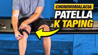 Relieve Knee Pain FAST Chondromalacia Patella K Taping [upl. by Shiff132]