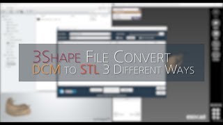 3Shape DCM 파일을 STL 파일로 변환하는 3가지 방법  How to Convert DCM to STL [upl. by Eneroc263]