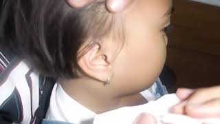 Little Girls Rock Hard Earwax Removed with Hydrogen Peroxide [upl. by Alyar]