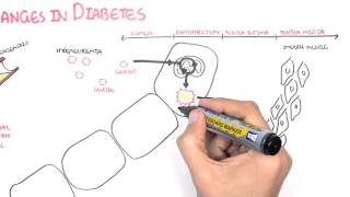 Diabetes Complication and Pathophysiology of the complication [upl. by Arada]