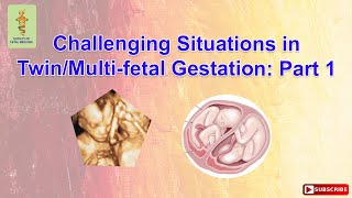 Challenging Situations in TwinMultifetal Gestation Part 1 [upl. by Rickie448]