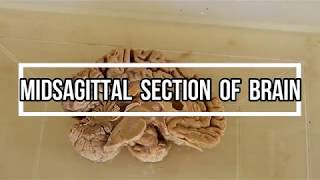 Midsagittal Section of Brain  neuroanatomy [upl. by Prince750]