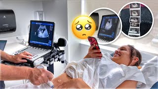 FIRST Ultrasound  Hearing The HEARTBEAT emotional [upl. by Eiveneg]