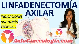 LINFADENECTOMÍA AXILAR TÉCNICA QUIRÚRGICA ANATOMÍA y PASOS 🏥 ✂️  Ginecología y Obstetricia [upl. by Ardath277]