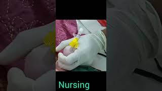 cannula insertion technic g [upl. by Georgiana350]