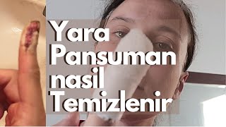 PANSUMAN NASIL YAPILIR  YARA TEMIZLEME  VLOG [upl. by Punke783]