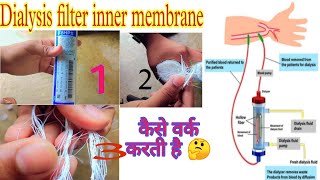 TYPES OF DIALYZER amp MEMBRANE DIALYZER INNER PART  डायलज़र और मेम्ब्रैंन के प्रकार और अंदर के परत🤔 [upl. by Ladnar]