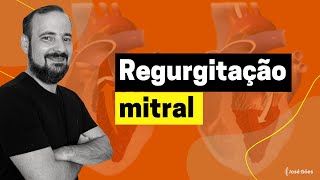 Regurgitação mitral  José Góes [upl. by Eeralih]