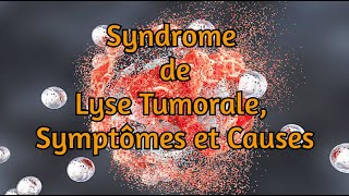 Syndrome de lyse tumorale symptômes et causes [upl. by Flight]