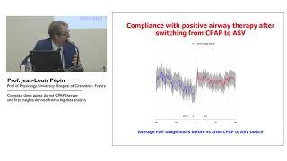 ResMed  Compliance after switching from CPAP to ASV [upl. by Lorsung]