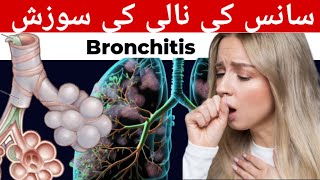 Bronchitis in HindiUrdu Causes Symptoms Bronchitis Treatment [upl. by Aeila707]