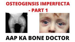 OSTEOGENESIS IMPERFECTA  PART 1  EPISODE 39 [upl. by Anrak]