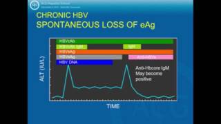 HBV  Natural History and Management [upl. by Leanard579]