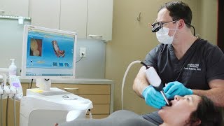 CEREC SameDay Crowns at Mint Hill Dentistry [upl. by Ambler]