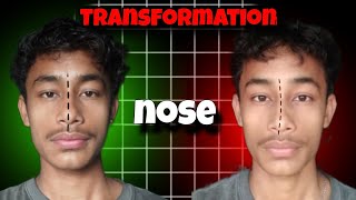 Nose Asymmetrical PROBLEM  HOW TO SOLVE NOSE ASYMMETRY  NO BS [upl. by Bethel]