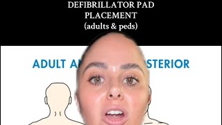 DEFIBRILLATOR PAD PLACEMENT adults and peds [upl. by Nalra915]