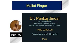 Part  02  Mallet finger  Hand surgery  Dr Pankaj Jindal [upl. by Archie]