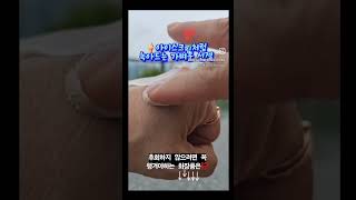 ❝ 내년 봄에 후회할 껄 ☝️❞덥다고 끕끕하다고 선크림도 안바른다구요난 안 탄다고 괜찮을 거라고 착각하지 마시길‼️ [upl. by Broderick]