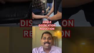 Ankle dislocation reduction [upl. by Mordecai799]