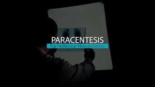 Paracentesis for Peritoneal Mesothelioma  Mesothelioma Hope [upl. by Bilicki]