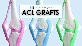 What are the different ACL Grafts  Which one is best Patella vs Hamstring [upl. by Mercie]