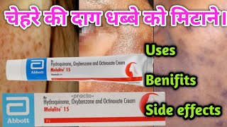 Melalite 15 Cream Benifits  Use  Side effects  Full Review in Hindi [upl. by Ecile325]