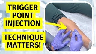 Trigger Points  Torsional Release Technique [upl. by Nigen16]