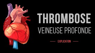 Thrombose Veineuse Profonde  Cardiologie  Détails [upl. by Nicks]