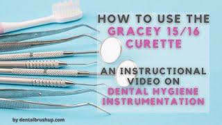 How to use the Gracey 1516 Curette [upl. by Ilhsa]