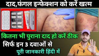 दाद और फंगल इनफेक्शन को ठीक करें सिर्फ इन 3 दवाओं से treatment for fungle infection [upl. by Aristotle]