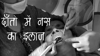 How to cure Gangrene गेंग्रीन in hindi Drywetgas Gangreneऑपरेशन से पीछा छुड़ाओ [upl. by Llydnek]