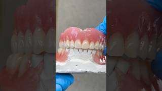 Denture and Partial Restoration lsk121shorts dentist teethsmile [upl. by Naaitsirhc]