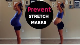 HOW TO PREVENT STRETCH MARKS DURING PREGNANCY 2nd Baby 36 Weeks [upl. by Ahseele71]