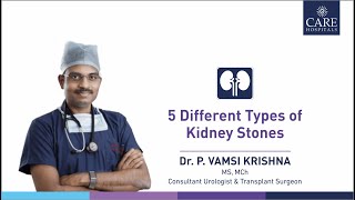 5 Different Types of Kidney Stones  Dr P Vamsi Krishna  CARE Hospitals [upl. by Waxman]