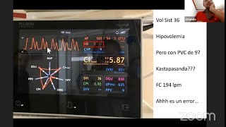 Monitoreo Hemodinámico Mitos y Realidades DrOrlando R Pérez Nieto [upl. by Ahtikal]