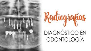 RADIOGRAFÍAS EN ORTODONCIA Y ODONTOLOGÍA  IMPRESCINDIBLES [upl. by Nanreik]