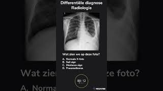 Differentiële diagnose Radiologie [upl. by Yekcim]